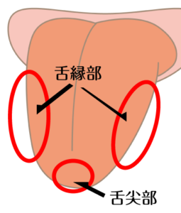 口腔がん（舌癌）