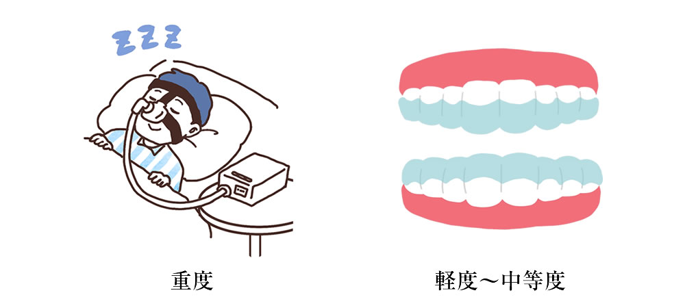 CPAP（経鼻的持続陽圧呼吸療法）